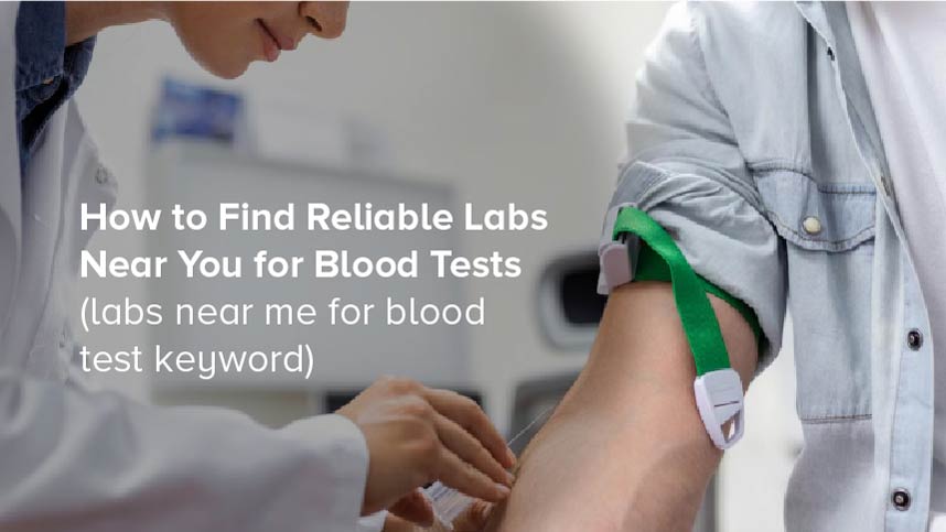 How to Find Reliable Labs Near You for Blood Tests
